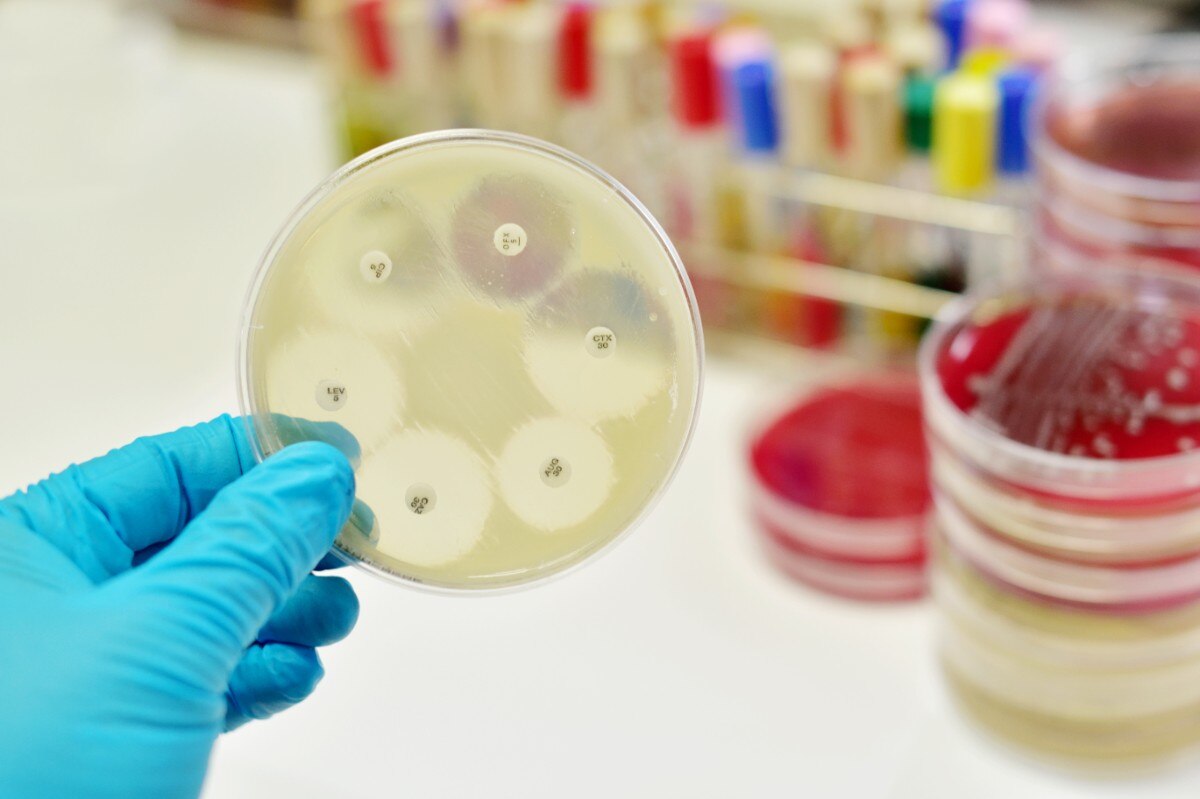 Antimicrobial susceptibility testing in petri dish; Shutterstock ID 490280845; Business Unit: Jones & Bartlett Learning; Project Name: ATI Fundamentals; ISBN or Project Number: ATI FUND; Element Number: ATIFUND_CH32_FIGF14